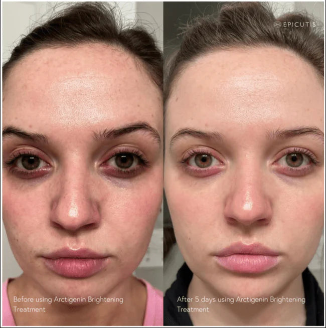 Arctigenin Brightening /treatment