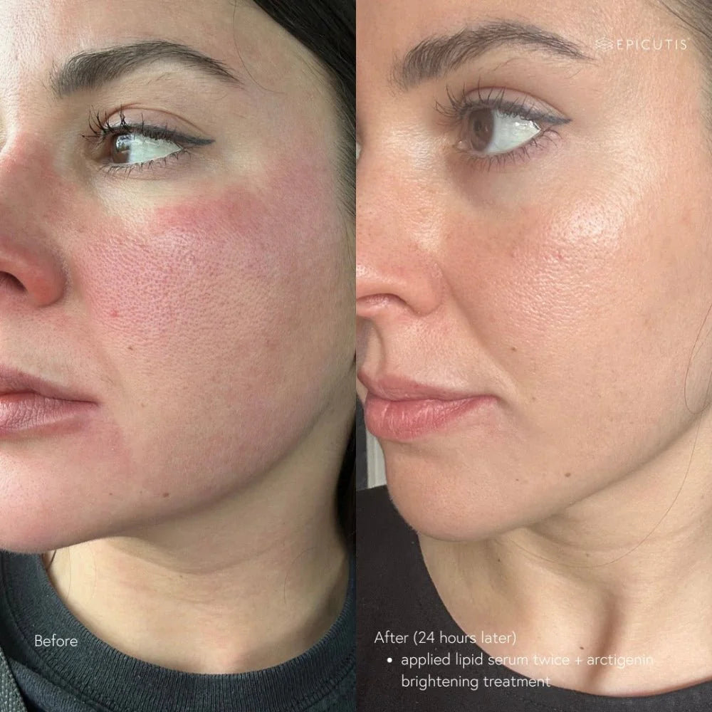 Arctigenin Brightening /treatment