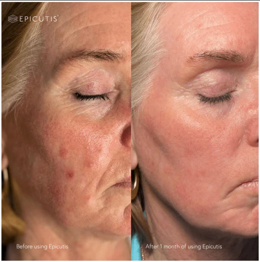 Lipid Serum
